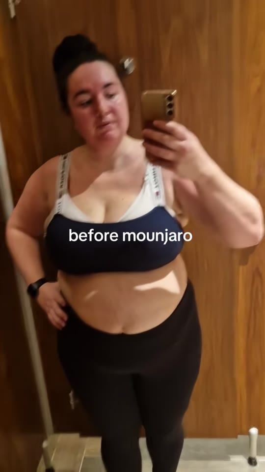 Mounjaro before-and-after videos: what the weight loss data really shows