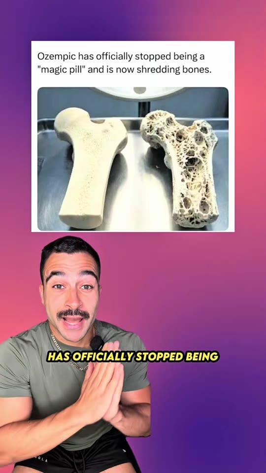 @sillz's Ozempic bone damage claims, fact-checked