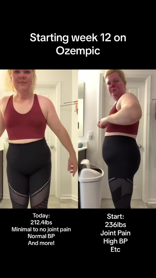 Week 12 on semaglutide: separating real results from TikTok hype