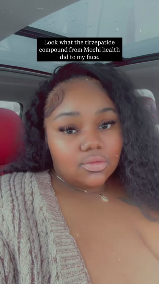 @simplymarissa1's tirzepatide transformation, fact-checked