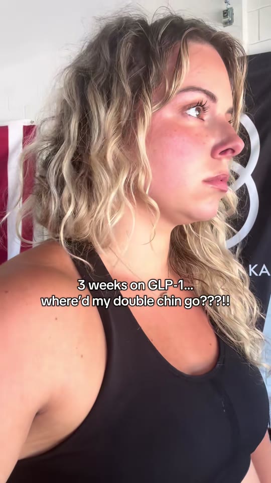 @karlilynnb1's double chin GLP-1 claims, fact-checked