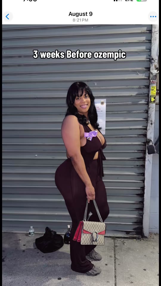 @hervirginhair's Ozempic weight loss claims, fact-checked