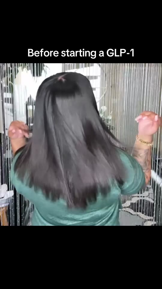 Hair loss claims from @kuuursten's GLP-1 journey, fact-checked