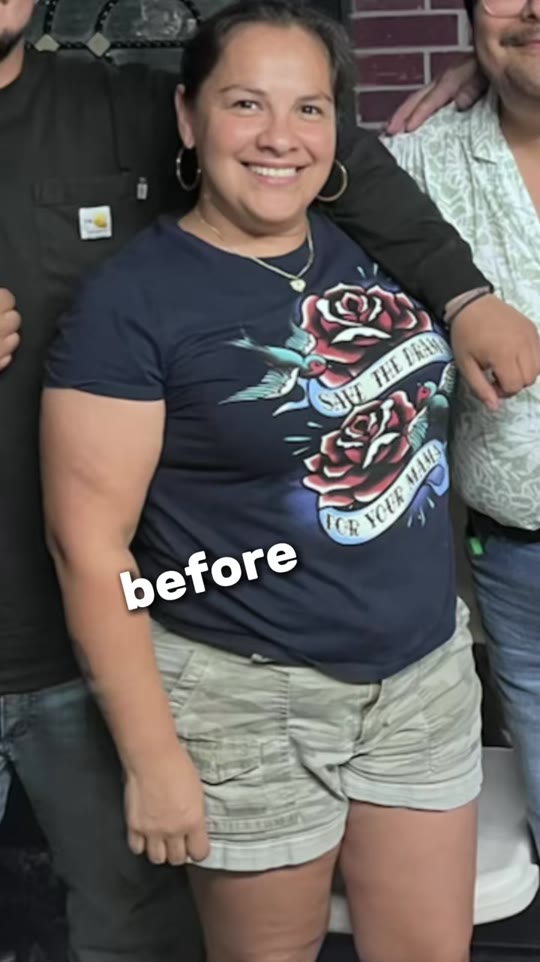 Tirzepatide 3-month results: what TikTok shows vs. trial data