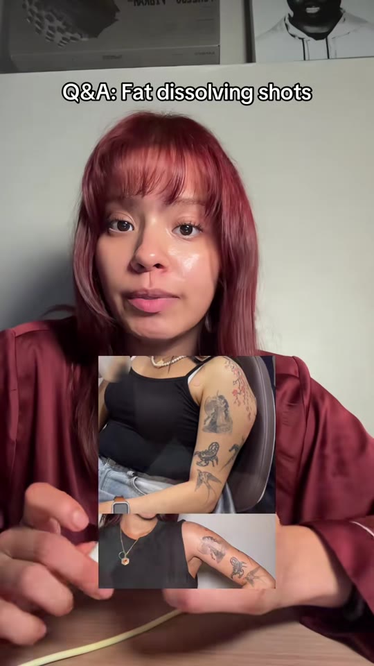 @valeeedgal's fat dissolving injection claims, fact-checked