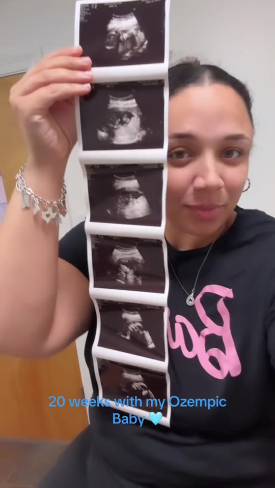 GLP-1 as a 'blessing': separating real results from hype