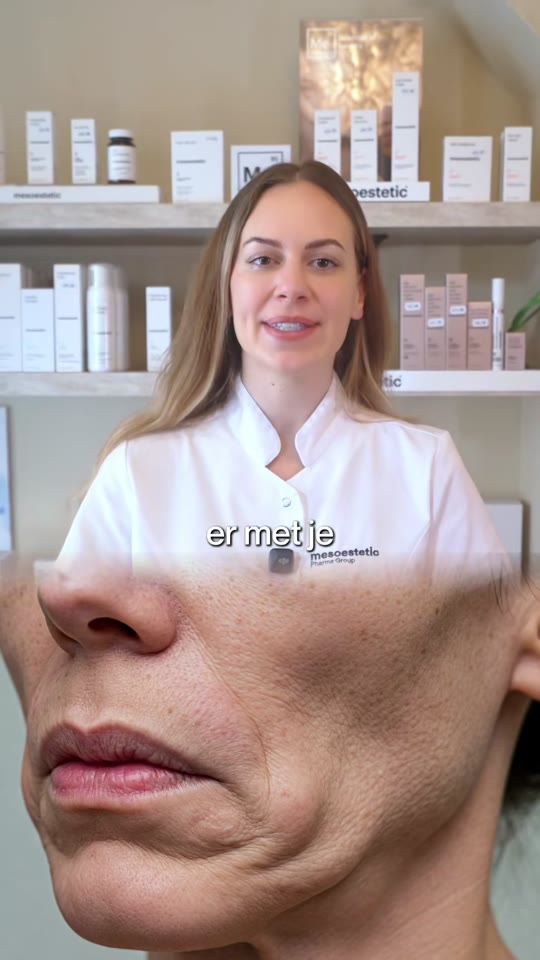 LumiSkin's 'Ozempic face' treatment claims, fact-checked