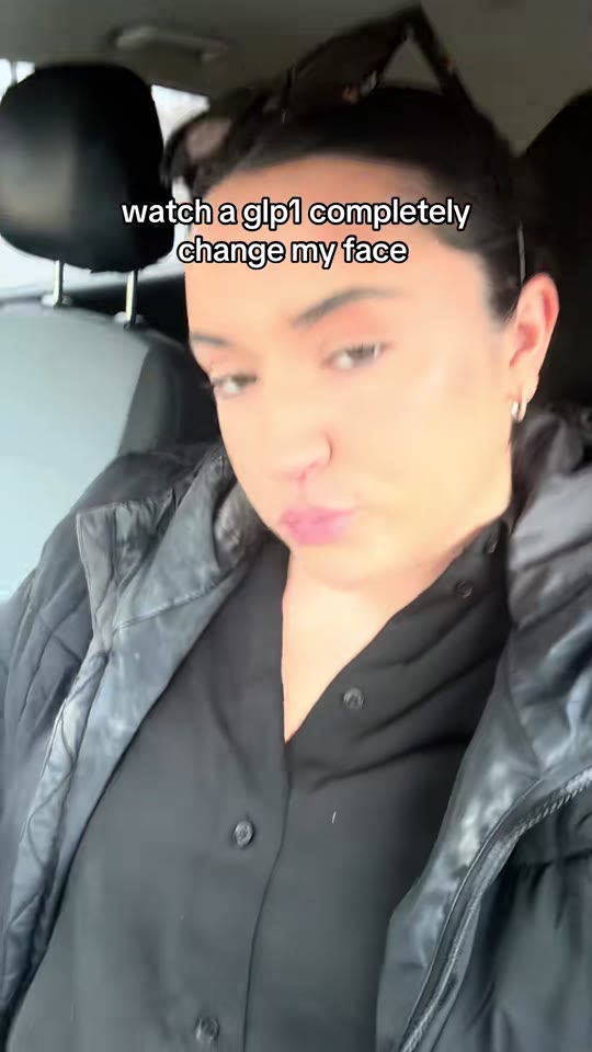 GLP-1s, PCOS, and the 'face transformation' trend on TikTok