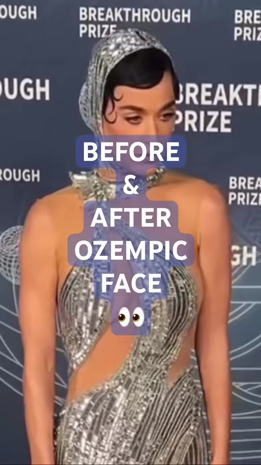 Ozempic face is real, but TikTok is overcomplicating it