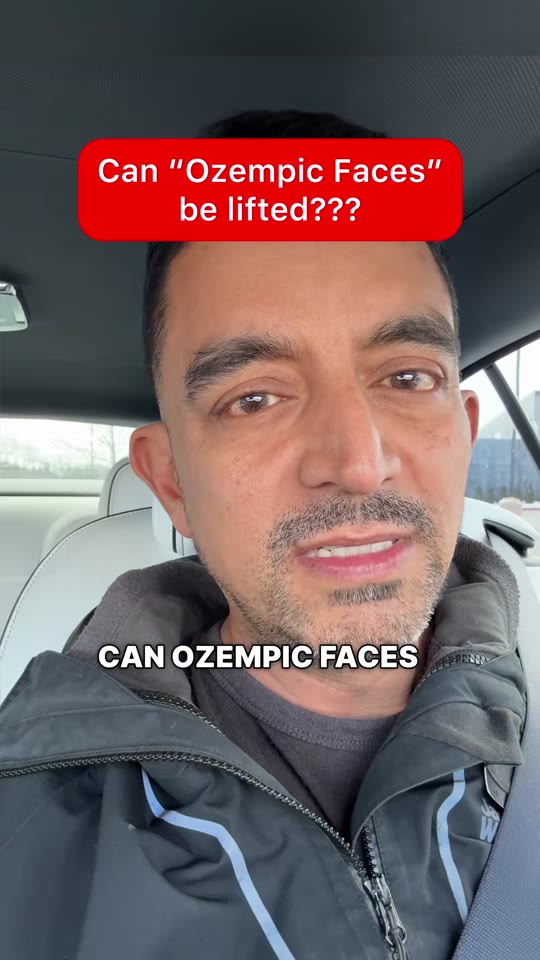 Does GLP-1 weight loss cause 'Ozempic face' and can surgery fix it?