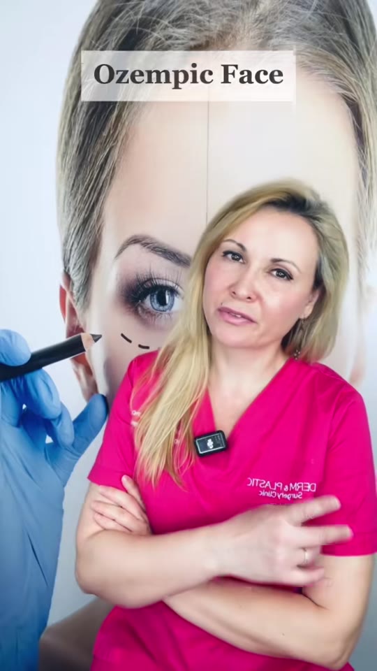 Ozempic face: real phenomenon or overhyped TikTok panic?