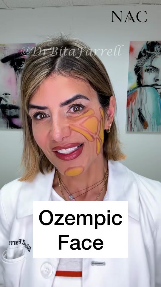 Dr. Farrell's claims about 'Ozempic face', fact-checked