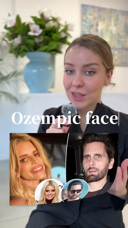 Does GLP-1 weight loss actually cause 'Ozempic face'?