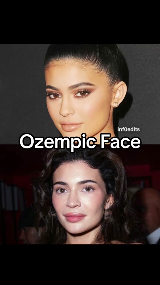 @shopinseason's Ozempic face claims need context