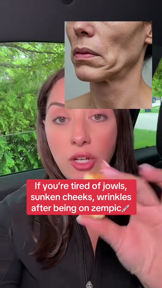 Does sea moss fix 'Ozempic face'? A closer look at the claims