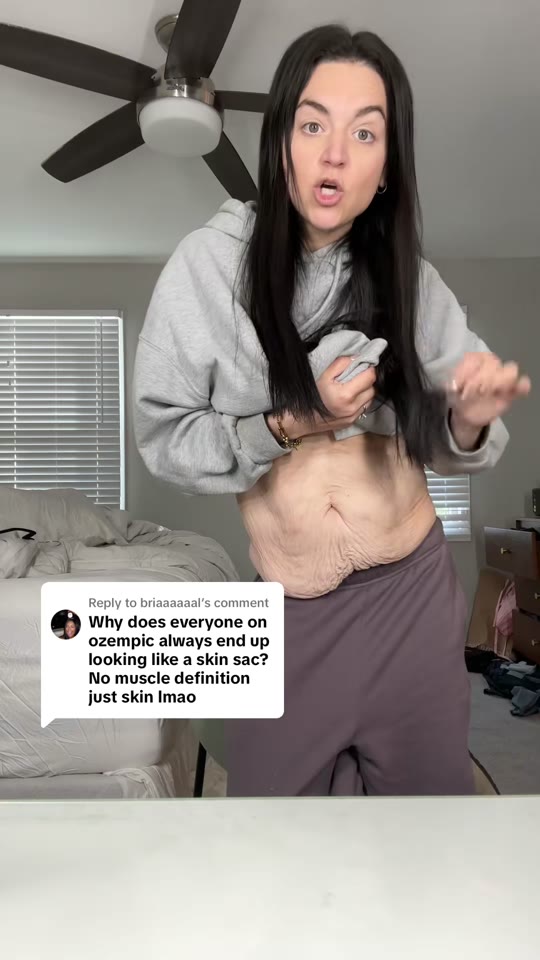 @amyinhalf's loose skin and GLP-1 claims, fact-checked