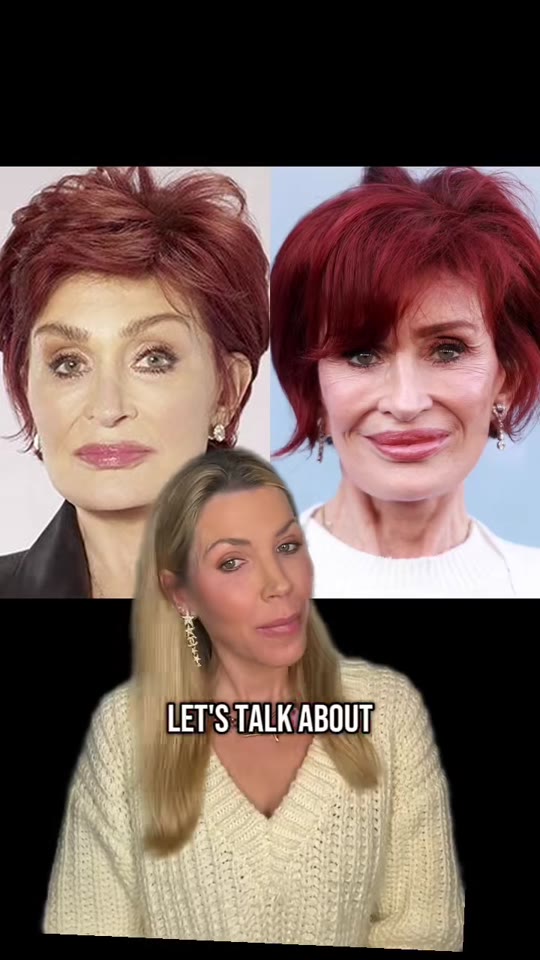 Dr. Armstrong's Ozempic face claims about Sharon Osbourne