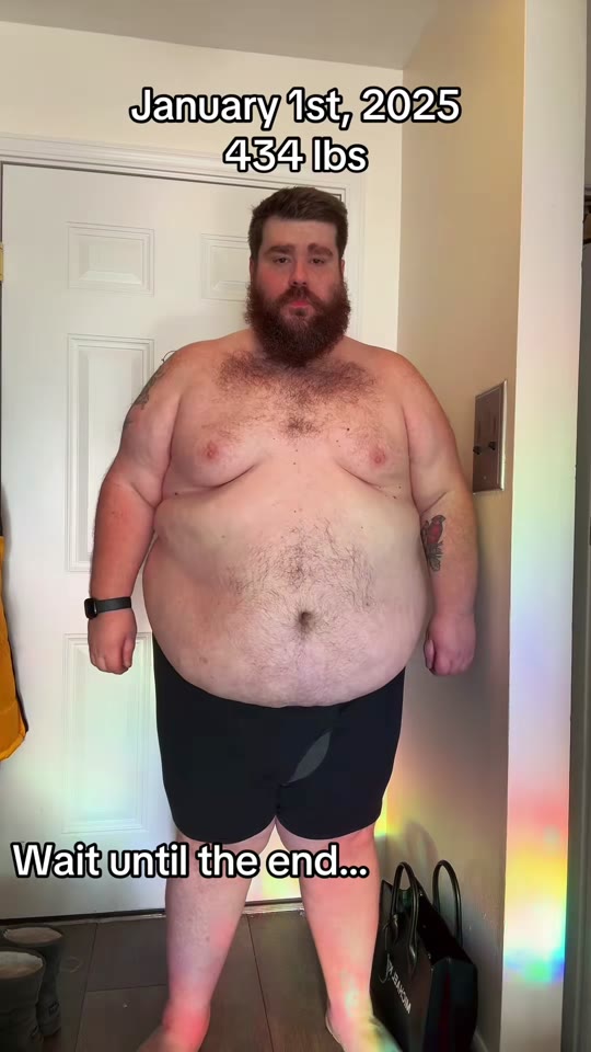 119 lbs in 12 months on GLP-1: what the numbers actually mean