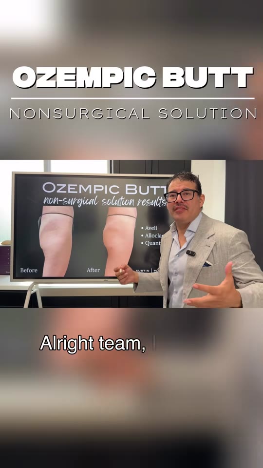 Plastic surgeon on TikTok and GLP-1s: separating the surgical from the speculative
