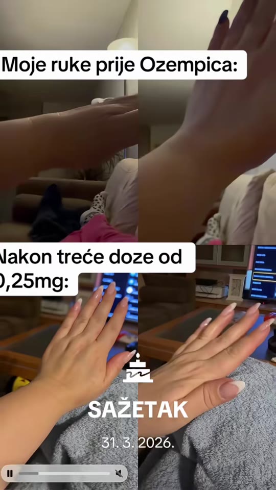 Ozempic weight loss claims on TikTok: separating hype from data