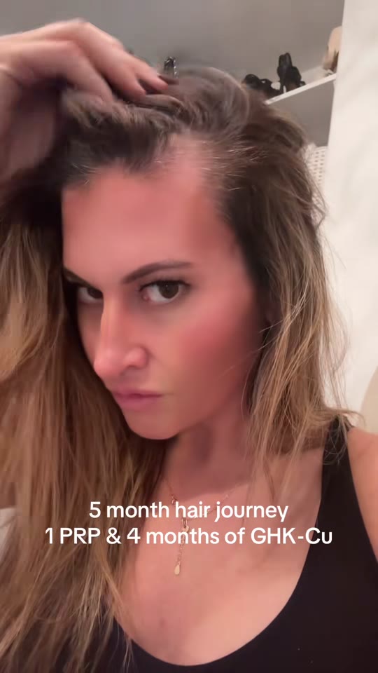 @zararaye_'s hair growth claims need more context