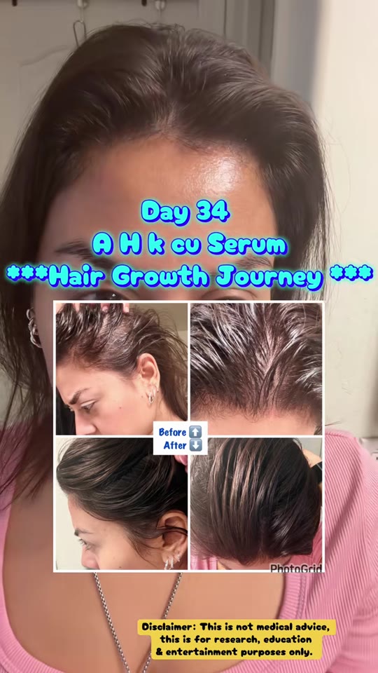 GHK-Cu for hair growth: what the peptide science actually shows