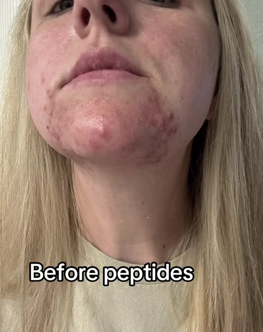 GHK-Cu for skin: what the evidence actually supports