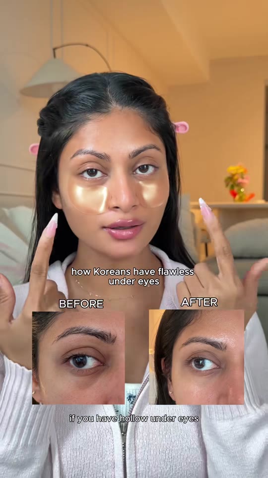 Volufiline and matrixyl for hollow eyes: what the evidence says