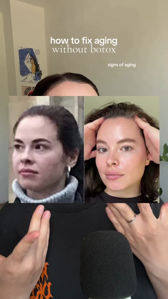 NMN in skincare: anti-aging breakthrough or overhyped supplement?