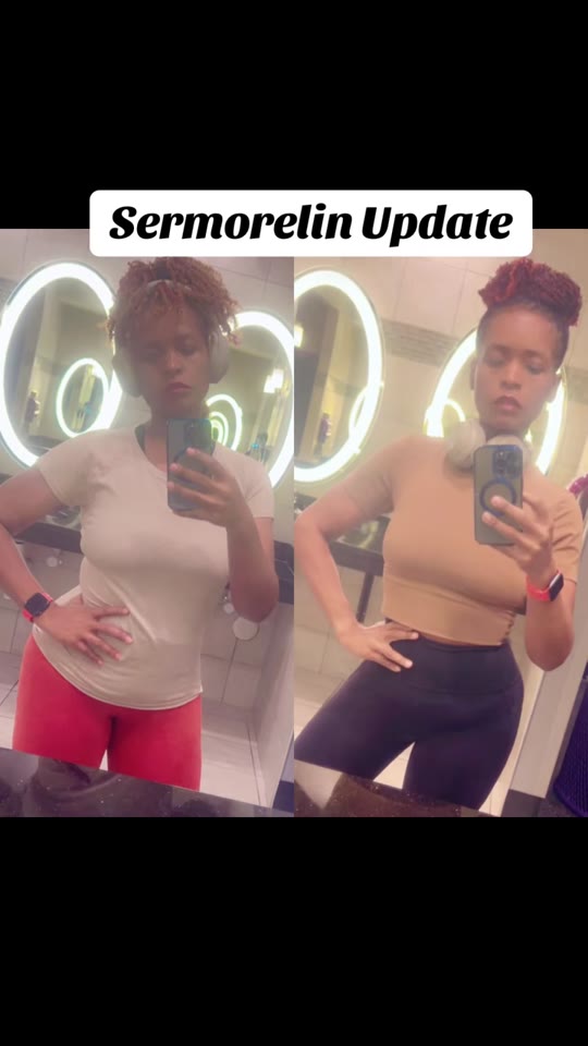 Sermorelin for body composition: what the before-and-after doesn't show