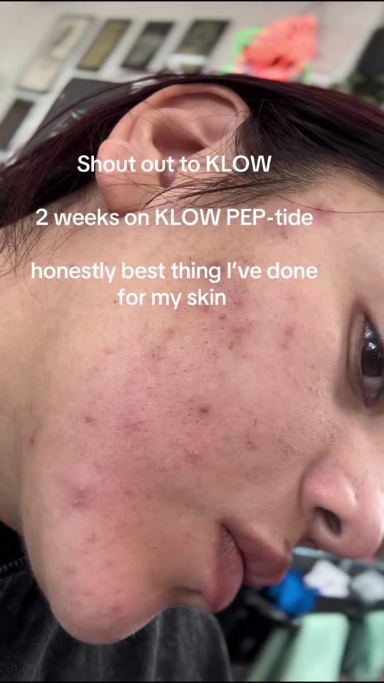 @brenadiana's K-Low peptide claims need more proof