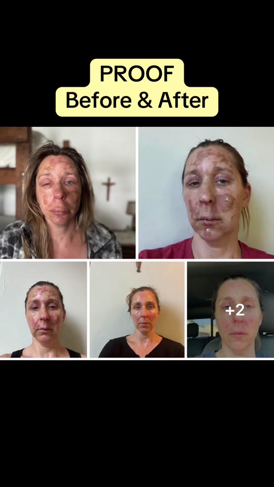 GHK-Cu copper peptides: healing miracle or overhyped biology?