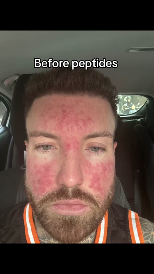 Luke's peptide transformation claims need more context