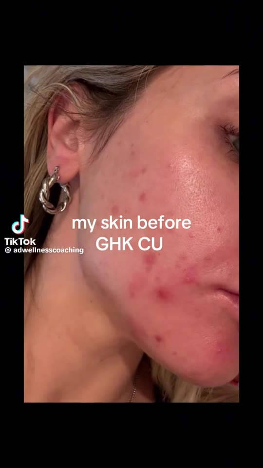 @dermawellnessuk's GHK-Cu before/after claims, fact-checked