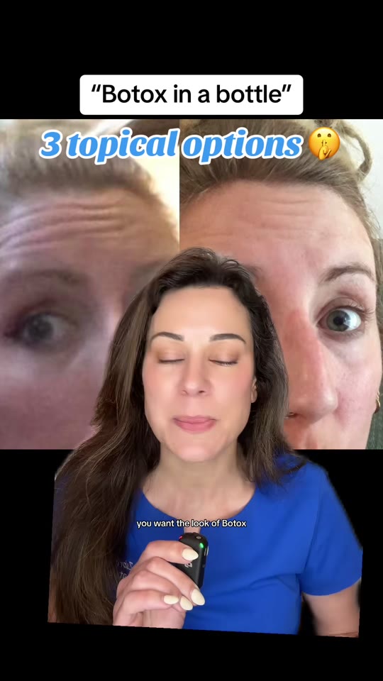 Argireline vs. Botox: what the peptide science actually shows