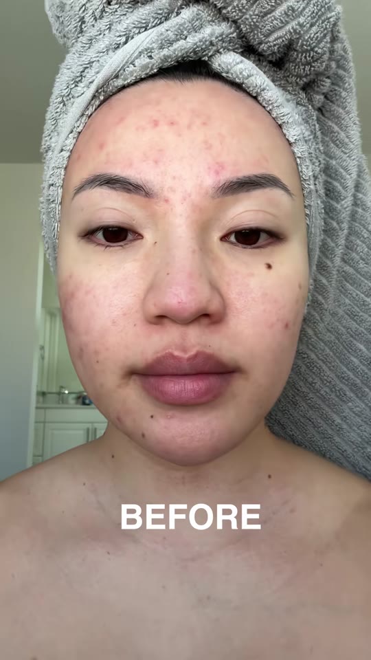 Copper peptides for skin: what GHK-Cu actually does