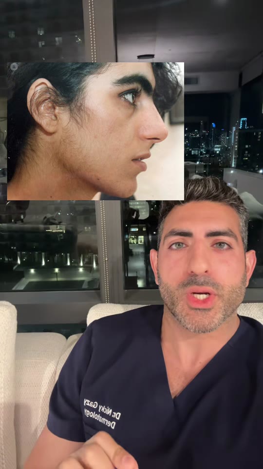 Eflornithine cream for facial hair: what the evidence actually shows