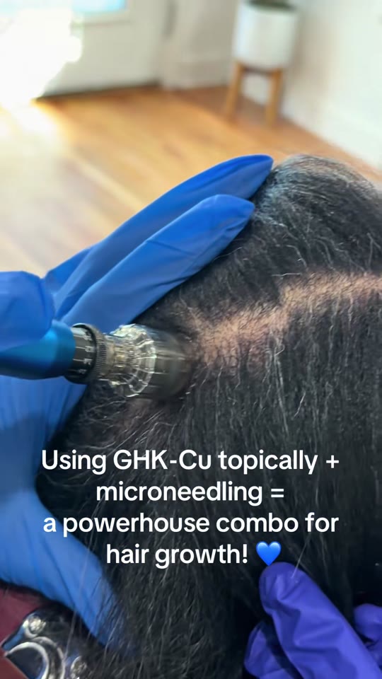 GHK-Cu and microneedling for hair growth: what the evidence actually shows