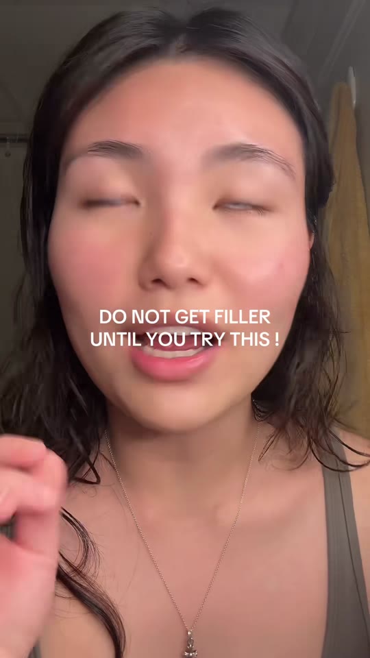 Can Matrixyl 10% actually replace filler? Here's what the data shows