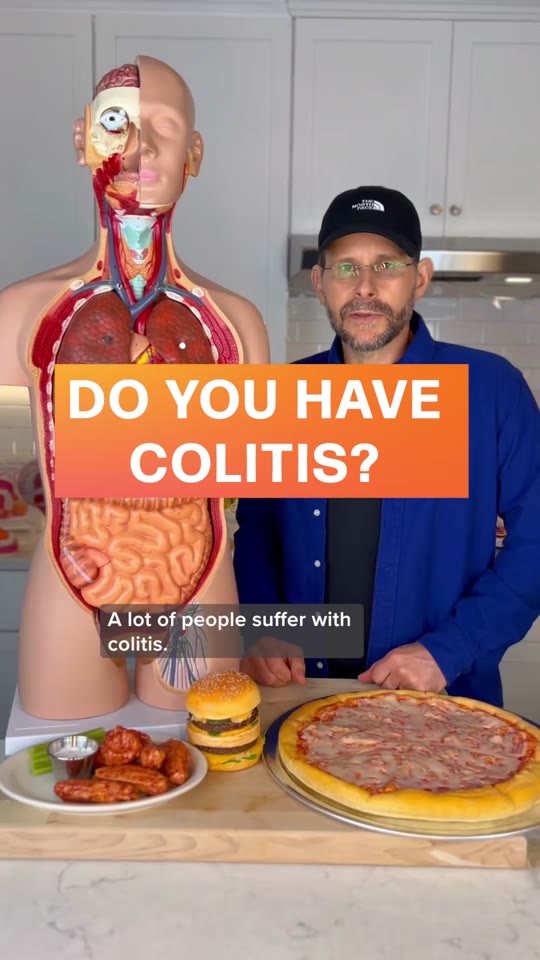No, shingles virus does not cause colitis — here's what does