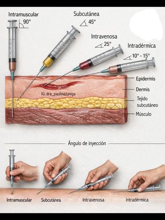Injection types in nursing education: what the science says