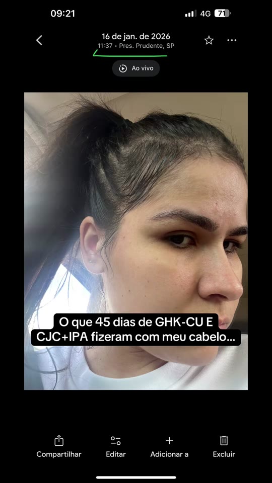 Caroline Almeida's peptide hair growth claims, fact-checked