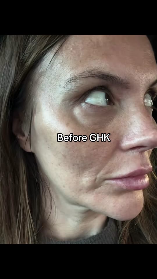 GHK-Cu peptide for skin and energy: what the evidence shows