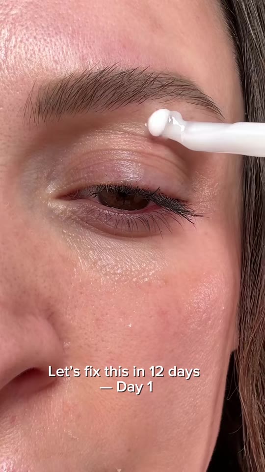 Can a Matrixyl ampoule fix your eye area in 12 days?
