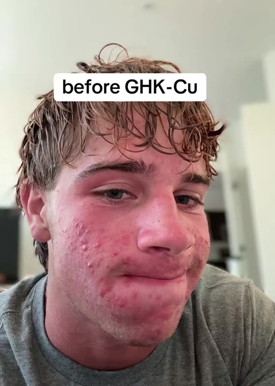@tupakhi's GHK-Cu copper peptide claims, fact-checked