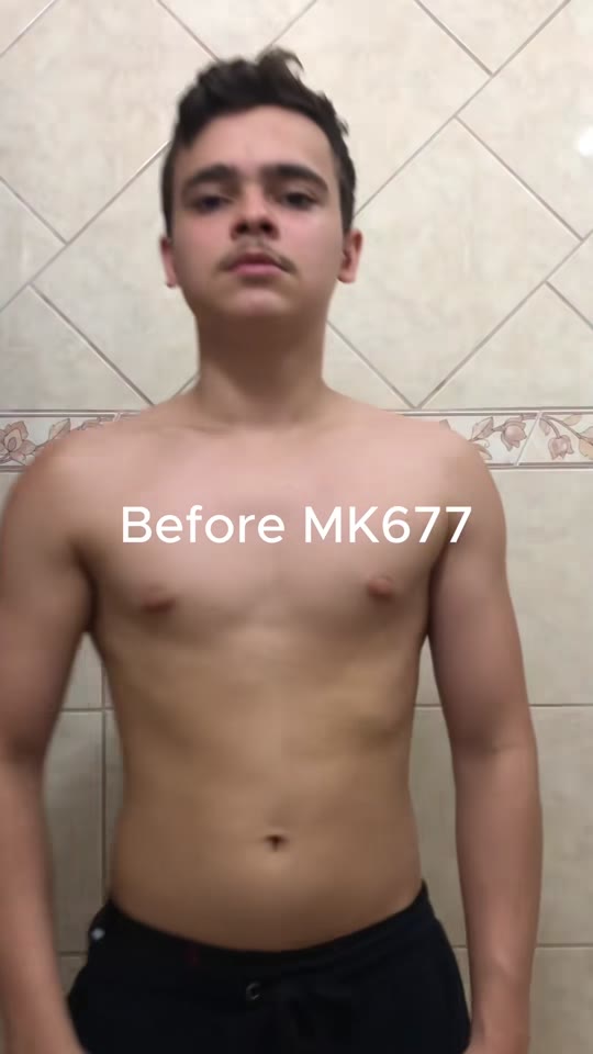 Peptide therapy TikTok claims: separating hype from human data