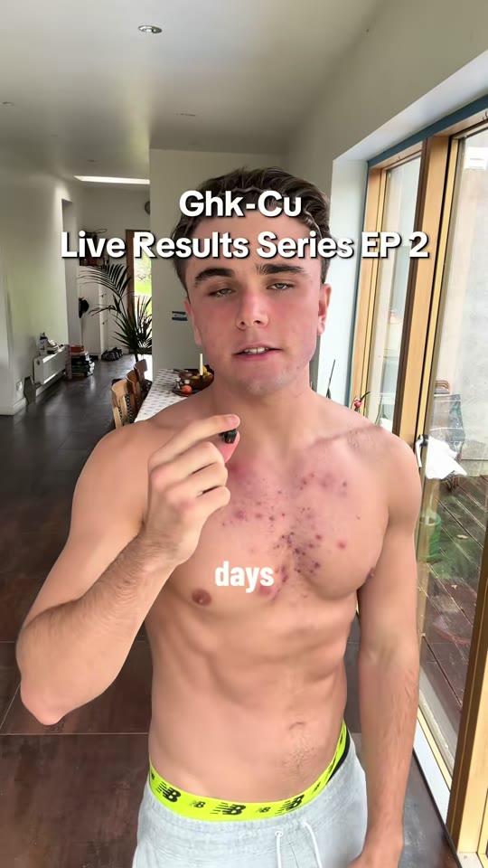 @coachcamoo's GHK-Cu peptide claims need more evidence