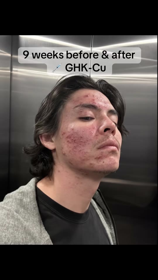 @thebagcollector69's GHK-Cu skin claims, fact-checked