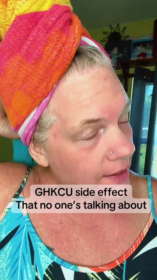 GHK-Cu and gray hair reversal: what the science actually supports