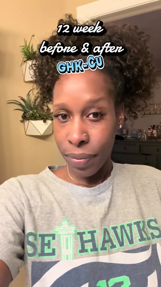 GHK-Cu peptide results after 12 weeks: what the science says